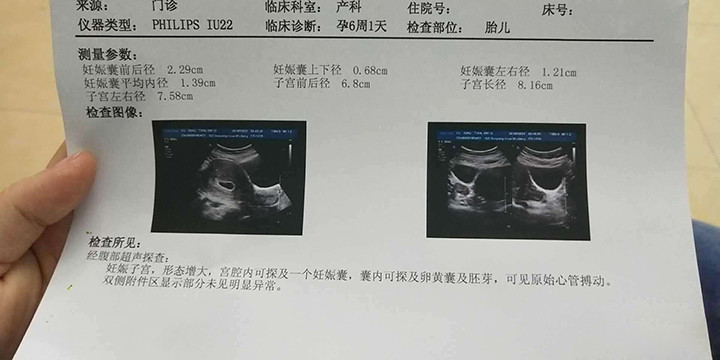 孕32周是几个月，全面解析孕期周数与月份转换